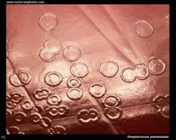 streptococcus pneumoniae colonies with depressed centers